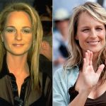 Helen Hunt Plastic Surgery Before and After