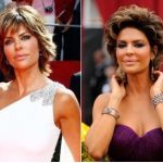 Lisa Rinna Plastic Surgery Before and After