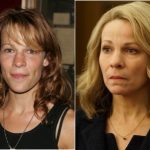 Lili Taylor Plastic Surgery Before and After