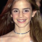 Emma Watson Plastic Surgery Before and After