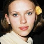 Scarlett Johansson Plastic Surgery Before and After