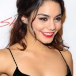 Vanessa Hudgens Plastic Surgery Before and After
