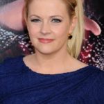 Melissa Joan Hart Plastic Surgery Before and After