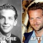 Bradley Cooper Plastic Surgery Before And After
