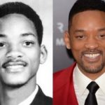 Will Smith Plastic Surgery Before And After