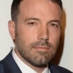 Ben Affleck Plastic Surgery Before and After