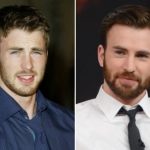Chris Evans Plastic Surgery Before and After