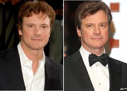 Colin Firth Plastic Surgery Before and After - Celebrity Surgeries