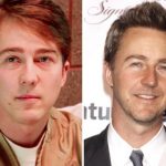 Edward Norton Plastic Surgery Before and After
