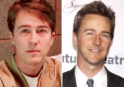 rp_Edward-Norton-1-2.jpg - Celebrity Surgeries