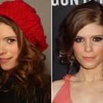 Kate Mara Plastic Surgery Before and After