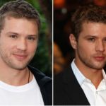 Ryan Phillippe Plastic Surgery Before and After