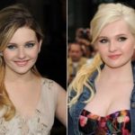 Abigail Breslin Plastic Surgery Before and After