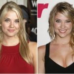 Ashley Benson Plastic Surgery Before and After