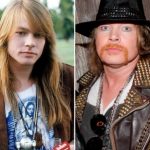 Axl Rose Plastic Surgery Before and After