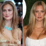 Bar Refaeli Plastic Surgery Before and After