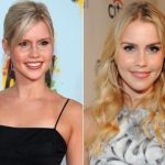 Claire Holt Plastic Surgery Before and After