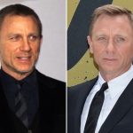 Daniel Craig Plastic Surgery Before and After