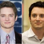 Elijah Wood Plastic Surgery Before and After
