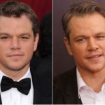 Matt Damon Plastic Surgery Before and After