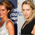 Teresa Palmer Plastic Surgery Before and After