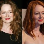 Miranda Otto Plastic Surgery Before and After