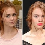 Holland Roden Plastic Surgery Before and After