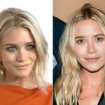 Mary-Kate Olsen Plastic Surgery Before and After