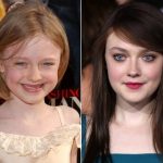Dakota Fanning Plastic Surgery Before and After