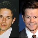 Mark Wahlberg Plastic Surgery Before and After