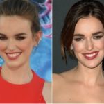 Elizabeth Henstridge Plastic Surgery Before and After