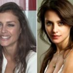Hannah Ware Plastic Surgery Before and After