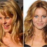 Candace Cameron Plastic Surgery Before and After