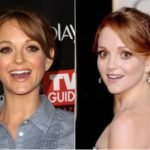 Jayma Mays Plastic Surgery Before and After