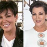 Kris Jenner Plastic Surgery Before and After