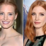 Jessica Chastain Plastic Surgery Before and After