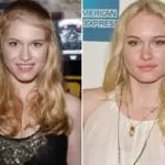 Leven Rambin Plastic Surgery Before and After