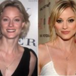 Teri Polo Plastic Surgery Before and After