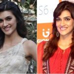 Kriti Sanon Plastic Surgery Before and After