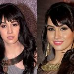 Lauren Gottlieb Plastic Surgery Before and After