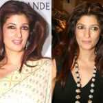 Twinkle Khanna Plastic Surgery Before and After