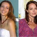 Amy Acker Plastic Surgery Before and After