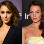 Camilla Luddington Plastic Surgery Before and After