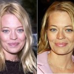 Jeri Ryan Plastic Surgery Before and After