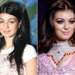 Ayesha Takia Plastic Surgery Before and After
