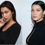Bella Hadid Plastic Surgery Before and After