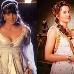 Lucy Lawless Plastic Surgery Before and After