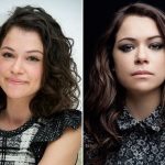 Tatiana Maslany Plastic Surgery Before and After