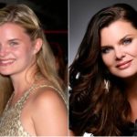 Heather Tom Plastic Surgery Before and After