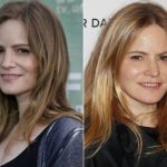 Jennifer Jason Leigh Plastic Surgery Before and After